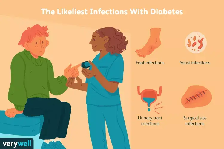 Effects of Diabetes on Immune System